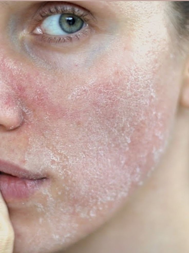 Makeup For Dry Skin